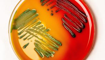 Integrale aanpak Listeria monocytogenes risico management leidt tot kostenreductie